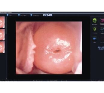 COLPOSCOPY SOFTWARE for 29624, 29625