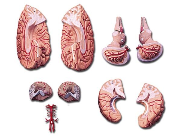 BRAIN WITH ARTERIES - Image 2